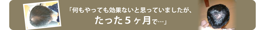 「何もやっても効果ないと思っていましたが、たった5ヶ月で・・・」