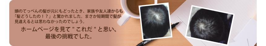 頭のてっぺんの髪が元にもどったとき、家族や友人経ちからも「髪どうしたの!?」と驚かれました