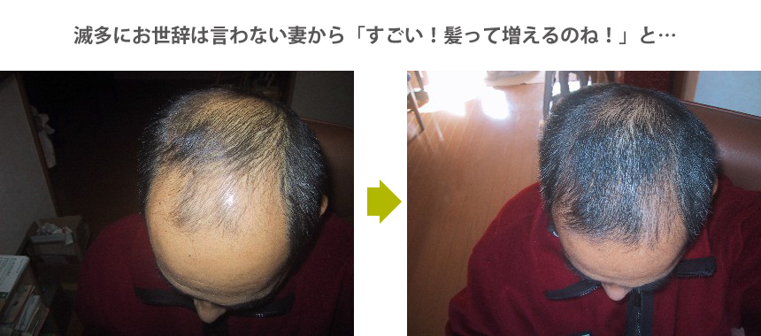 お世辞を言わない妻から「すごい!髪って増えるのね!」と