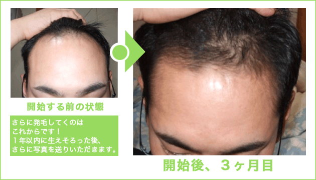 育毛の達人